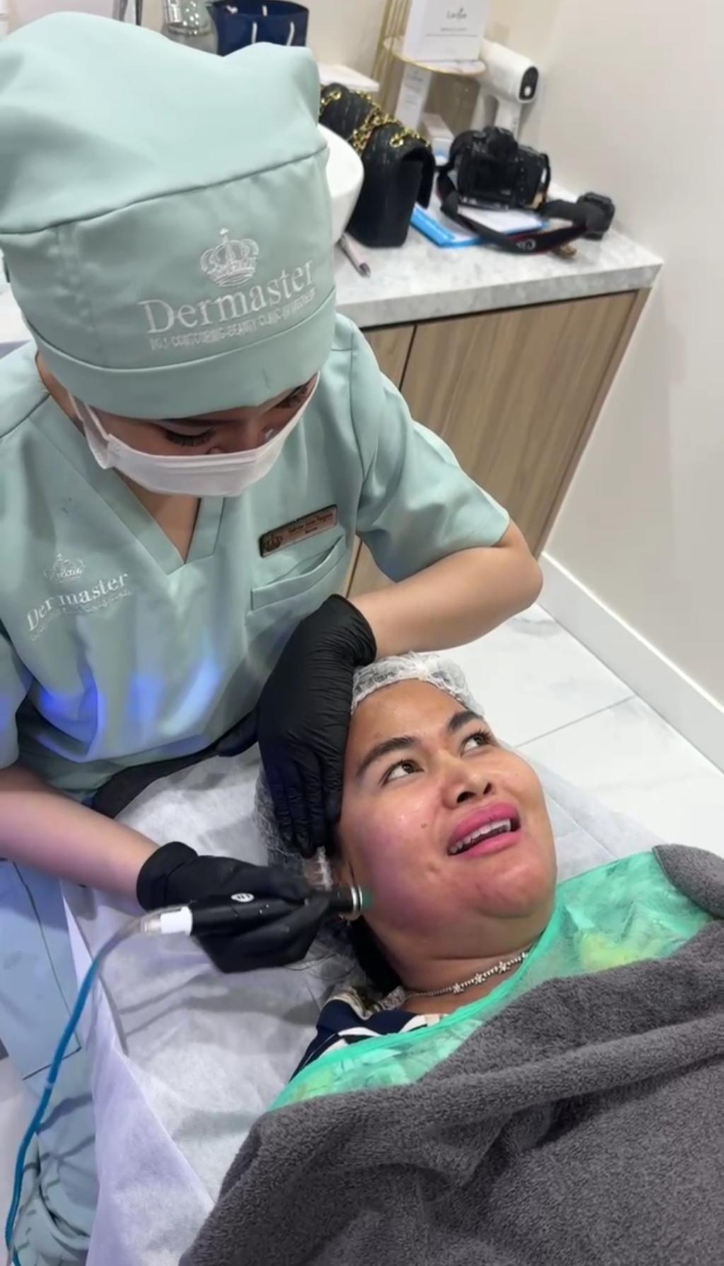 Elegansi dan Apresiasi Diri: Camel Petir Jajal Treatment Premium di Dermaster Clinic